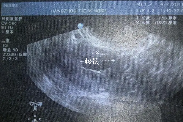 试管内膜ABC分别代表不同的意思